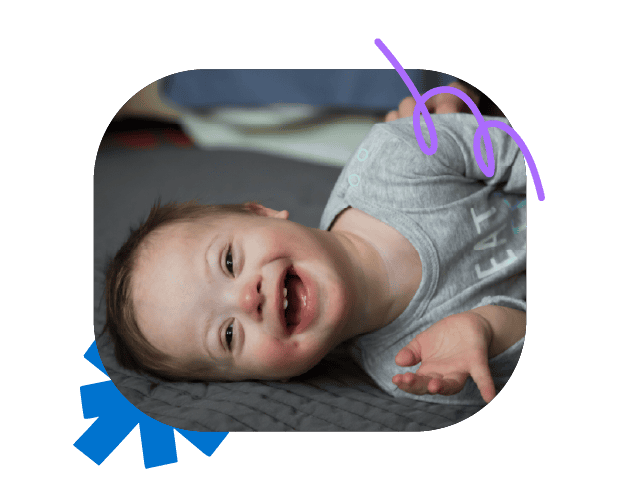 Young child with speech delay lying on bed, demonstrating speech therapy needs for children with communication difficulties.